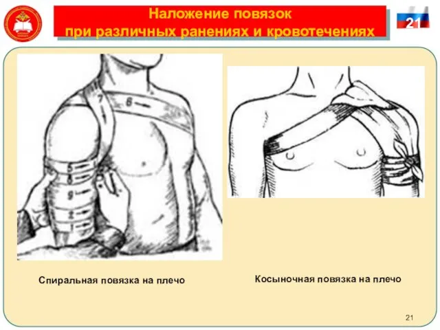 Наложение повязок при различных ранениях и кровотечениях 21 Спиральная повязка на плечо Косыночная повязка на плечо