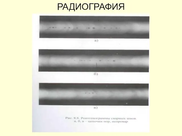 РАДИОГРАФИЯ