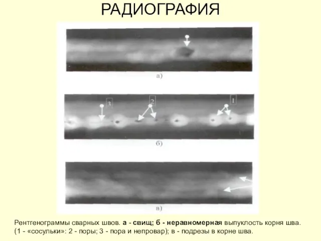 РАДИОГРАФИЯ Рентгенограммы сварных швов. а - свищ; б - неравномерная выпуклость