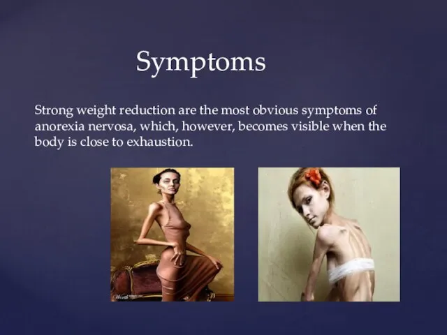 Strong weight reduction are the most obvious symptoms of anorexia nervosa,