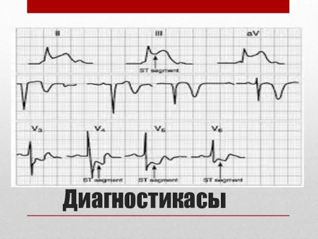 Диагностикасы