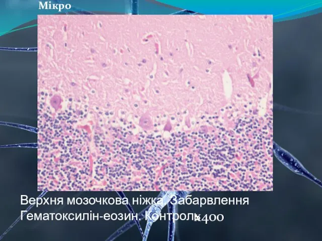 Верхня мозочкова ніжка. Забарвлення Гематоксилін-еозин. Контроль Мікро х400