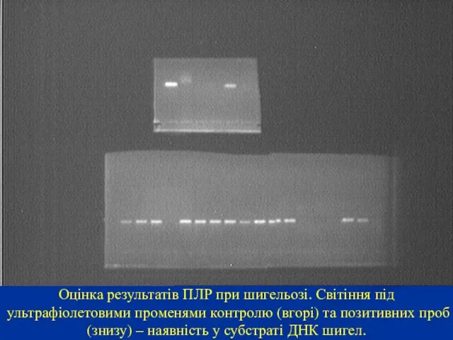 Оцінка результатів ПЛР при шигельозі. Світіння під ультрафіолетовими променями контролю (вгорі)