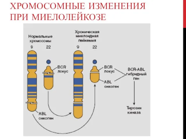 ХРОМОСОМНЫЕ ИЗМЕНЕНИЯ ПРИ МИЕЛОЛЕЙКОЗЕ