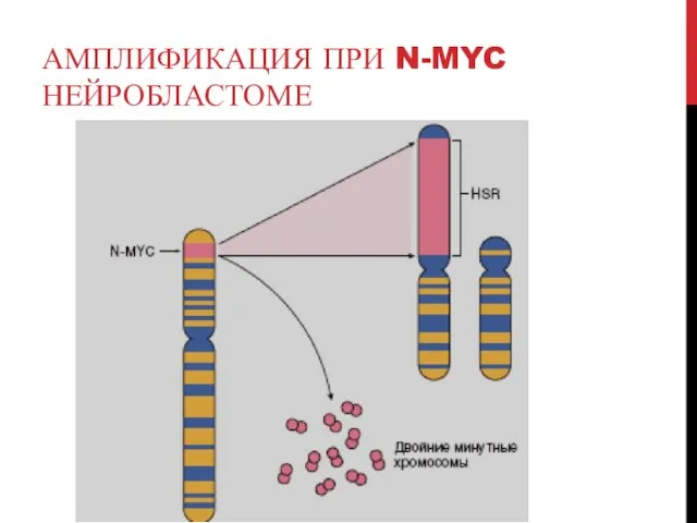 АМПЛИФИКАЦИЯ ПРИ N-MYC НЕЙРОБЛАСТОМЕ