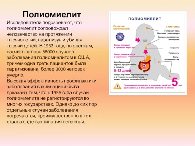 Полиомиелит Исследователи подозревают, что полиомиелит сопровождал человечество на протяжении тысячелетий, парализуя