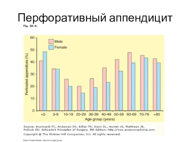 Перфоративный аппендицит