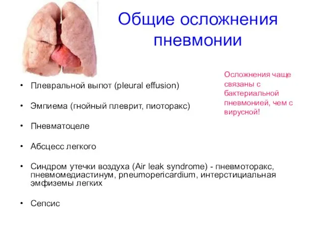 Общие осложнения пневмонии Плевральной выпот (pleural effusion) Эмпиема (гнойный плеврит, пиоторакс)