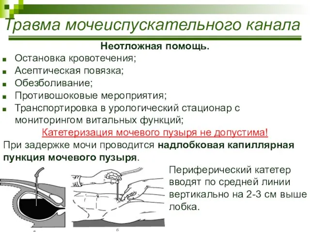 Травма мочеиспускательного канала Неотложная помощь. Остановка кровотечения; Асептическая повязка; Обезболивание; Противошоковые