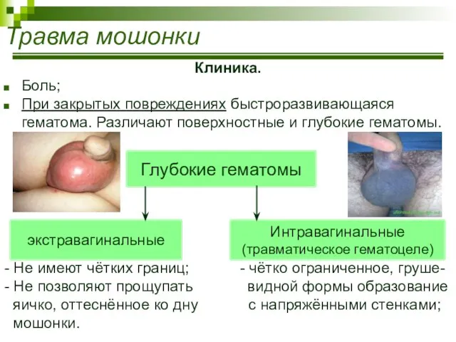 Травма мошонки Клиника. Боль; При закрытых повреждениях быстроразвивающаяся гематома. Различают поверхностные