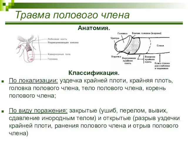 Травма полового члена Анатомия. Классификация. По локализации: уздечка крайней плоти, крайняя