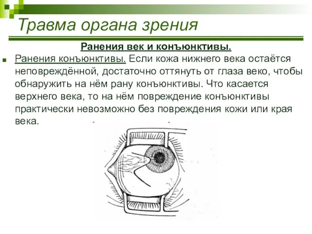 Травма органа зрения Ранения век и конъюнктивы. Ранения конъюнктивы. Если кожа