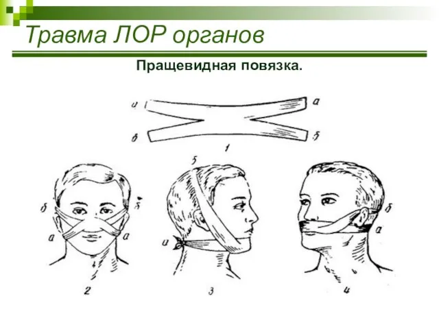 Травма ЛОР органов Пращевидная повязка.