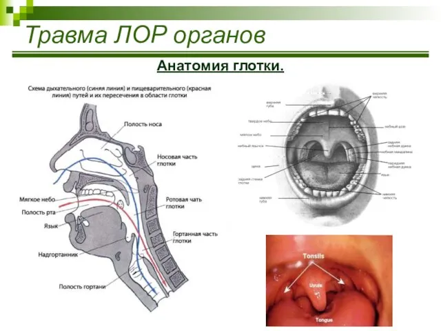 Травма ЛОР органов Анатомия глотки.