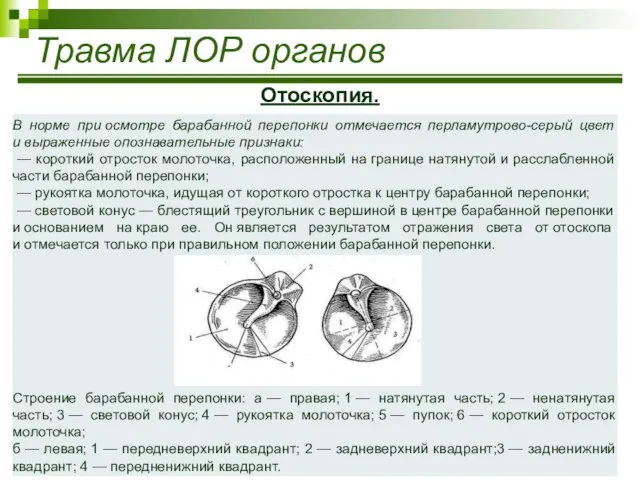 Травма ЛОР органов Отоскопия. В норме при осмотре барабанной перепонки отмечается