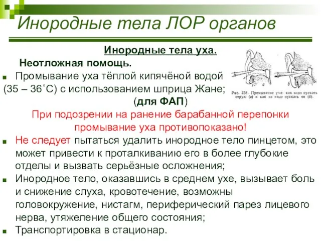 Инородные тела ЛОР органов Инородные тела уха. Неотложная помощь. Промывание уха