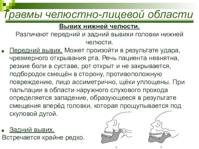 Травмы челюстно-лицевой области Вывих нижней челюсти. Различают передний и задний вывихи