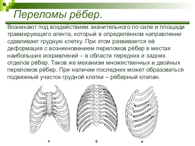 Возникают под воздействием значительного по силе и площади травмирующего агента, который