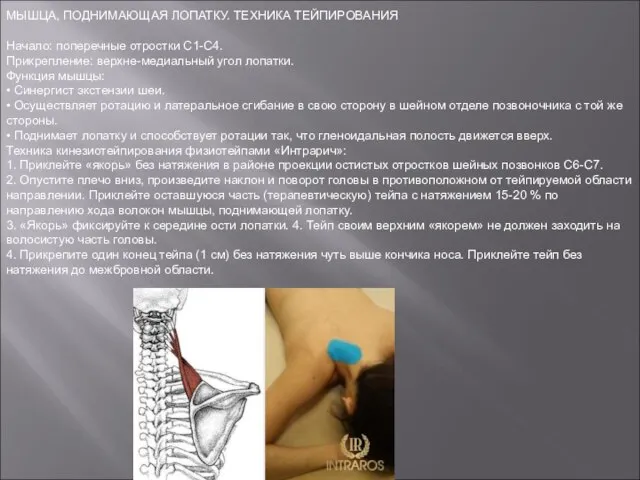 МЫШЦА, ПОДНИМАЮЩАЯ ЛОПАТКУ. ТЕХНИКА ТЕЙПИРОВАНИЯ Начало: поперечные отростки С1-С4. Прикрепление: верхне-медиальный