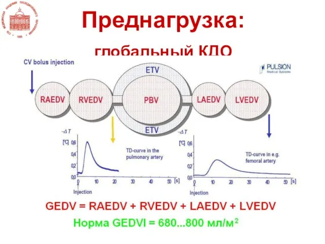 Преднагрузка: глобальный КДО