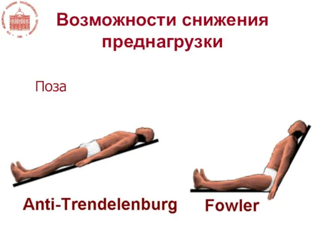 Возможности снижения преднагрузки Поза Венозные жгуты Эксфузия крови Диуретики Венодилататоры