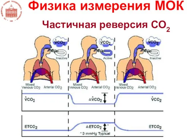 Физика измерения МОК Частичная реверсия СО2