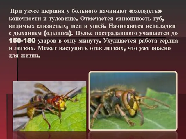 При укусе шершня у больного начинают «холодеть» конечности и туловище. Отмечается