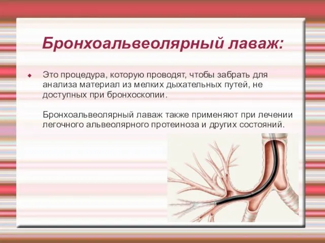 Бронхоальвеолярный лаваж: Это процедура, которую проводят, чтобы забрать для анализа материал