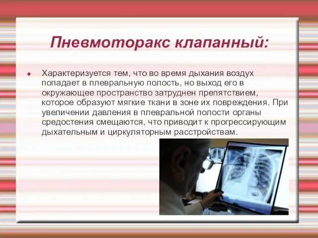 Пневмоторакс клапанный: Характеризуется тем, что во время дыхания воздух попадает в