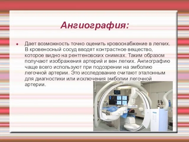 Ангиография: Дает возможность точно оценить кровоснабжение в легких. В кровеносный сосуд