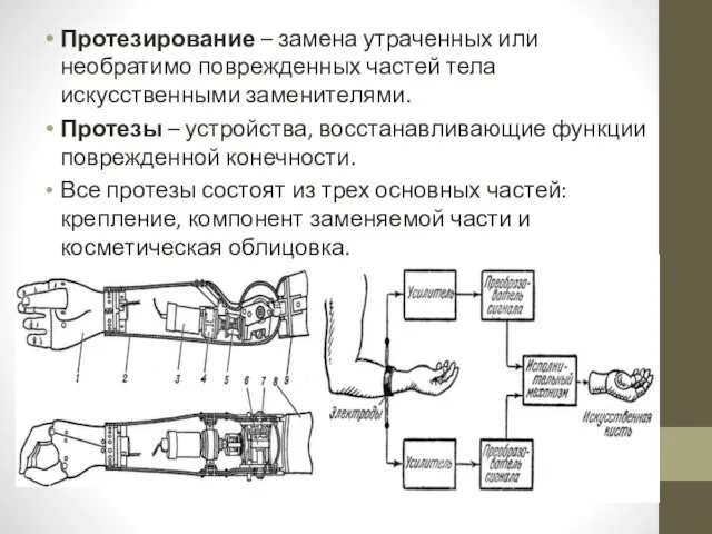 Протезирование – замена утраченных или необратимо поврежденных частей тела искусственными заменителями.