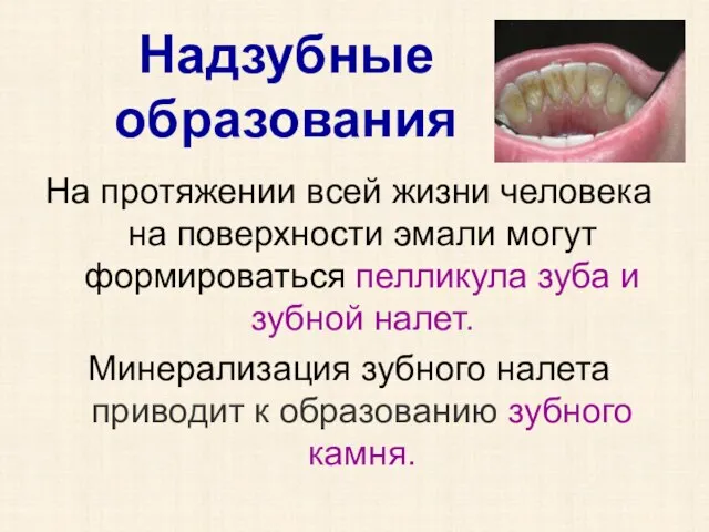 Надзубные образования На протяжении всей жизни человека на поверхности эмали могут