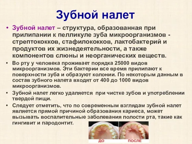 Зубной налет Зубной налет – структура, образованная при прилипании к пелликуле