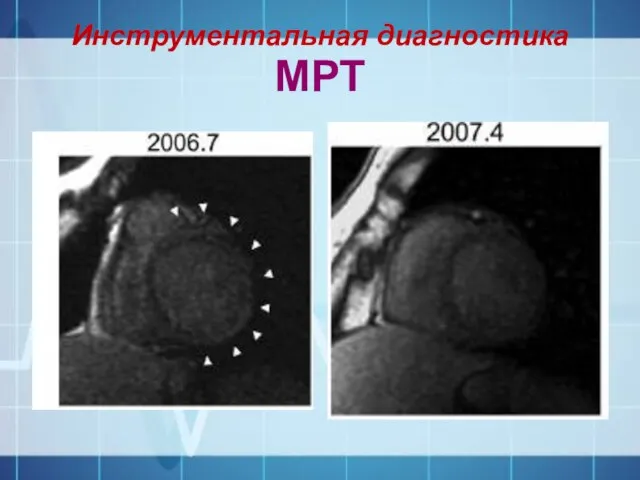 Инструментальная диагностика МРТ