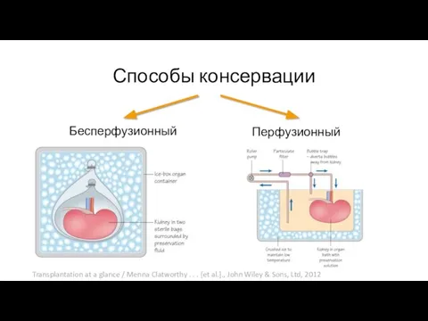 Способы консервации Бесперфузионный Перфузионный Transplantation at a glance / Menna Clatworthy