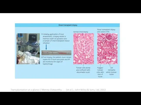 Transplantation at a glance / Menna Clatworthy . . . [et