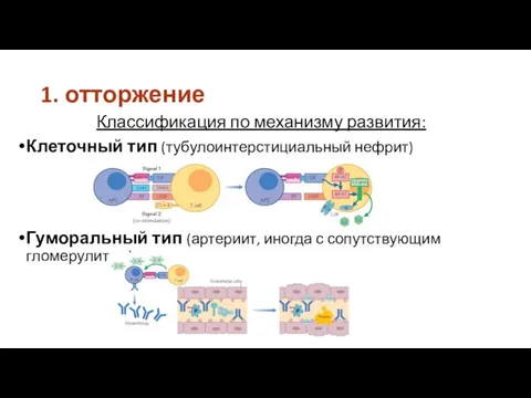 1. отторжение Классификация по механизму развития: Клеточный тип (тубулоинтерстициальный нефрит) Гуморальный