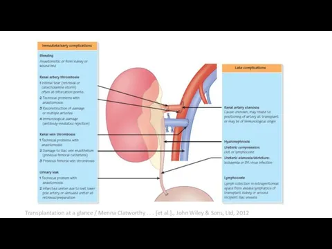 Transplantation at a glance / Menna Clatworthy . . . [et