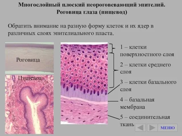 Многослойный плоский неороговевающий эпителий. Роговица глаза (пищевод) Обратить внимание на разную