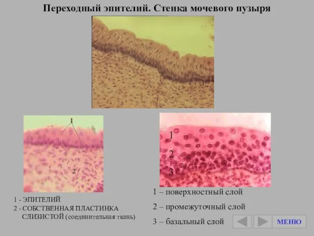 Переходный эпителий. Стенка мочевого пузыря 1 - ЭПИТЕЛИЙ 2 - СОБСТВЕННАЯ