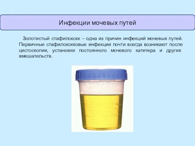 Золотистый стафилококк – одна из причин инфекций мочевых путей. Первичные стафилококковые