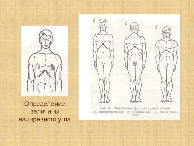 Определение величины надчревного угла