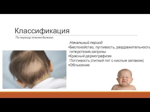 Классификация По периоду течения болезни Начальный период Беспокойство, пугливость, раздражительность, гиперстезия,капризы