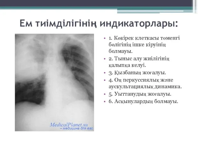 Ем тиімділігінің индикаторлары: 1. Көкірек клеткасы төменгі бөлігінің ішке кіруінің болмауы.