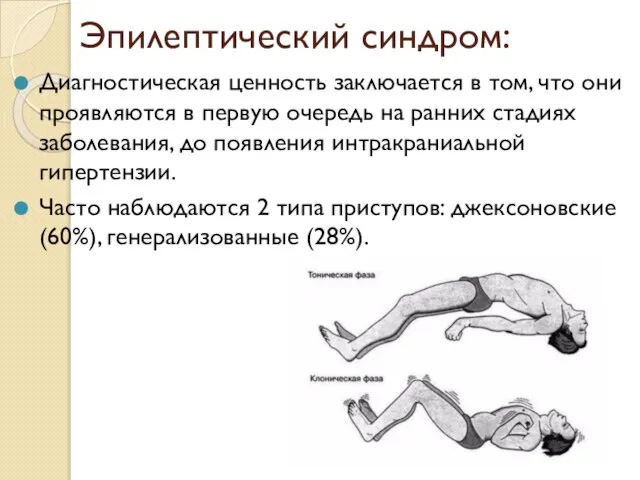 Эпилептический синдром: Диагностическая ценность заключается в том, что они проявляются в