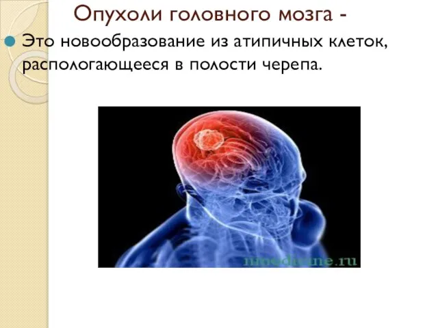 Опухоли головного мозга - Это новообразование из атипичных клеток, распологающееся в полости черепа.