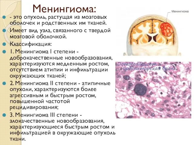 Менингиома: - это опухоль, растущая из мозговых оболочек и родственных им