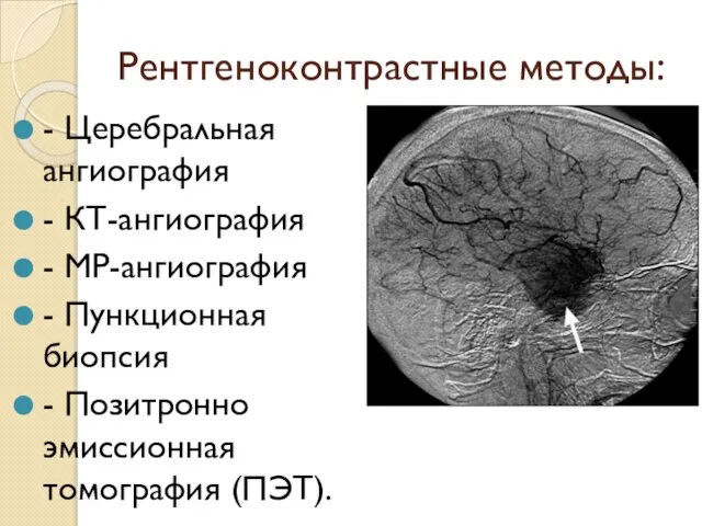 Рентгеноконтрастные методы: - Церебральная ангиография - КТ-ангиография - МР-ангиография - Пункционная