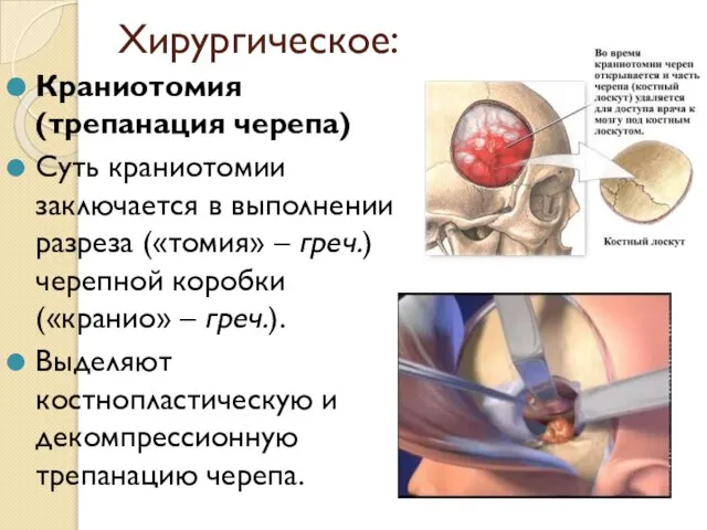 Хирургическое: Краниотомия (трепанация черепа) Суть краниотомии заключается в выполнении разреза («томия»