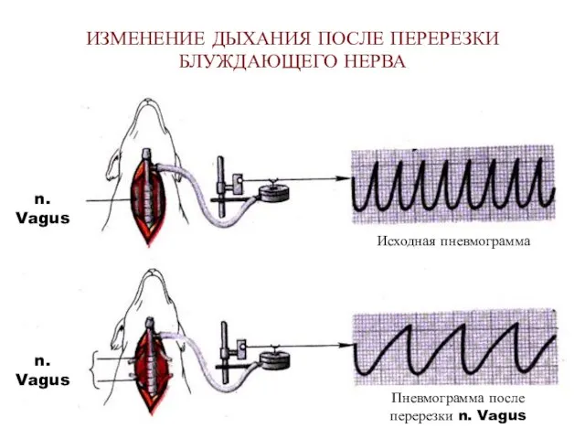 ИЗМЕНЕНИЕ ДЫХАНИЯ ПОСЛЕ ПЕРЕРЕЗКИ БЛУЖДАЮЩЕГО НЕРВА Исходная пневмограмма Пневмограмма после перерезки